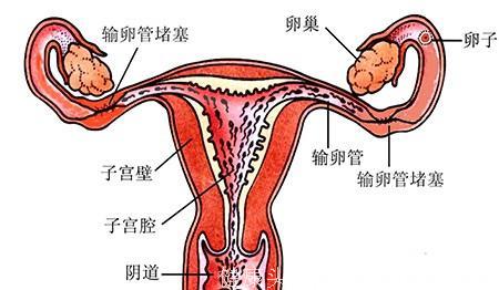 女性不孕，来测测你输卵管的通常度！