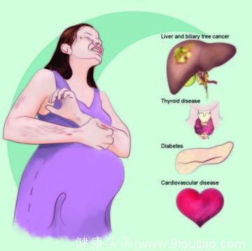 孕期皮肤瘙痒很正常，但这三种可能引起胎儿早产，一定要注意！