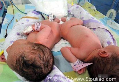 宝妈怀双胞胎孕检7次均健康，孩子出生后家属却要告医院
