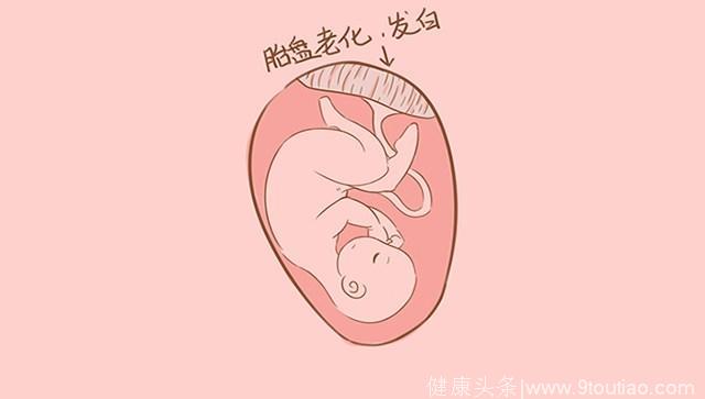 产检单上的这个指标可看出胎宝宝的出生时间，孕妈看懂了吗