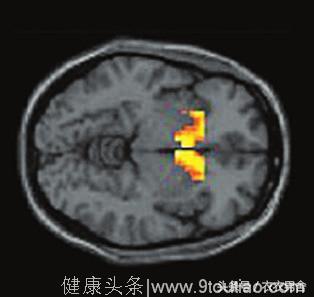 「有害大脑、让人成瘾、加深性暴力」色情到底会影响你什么？