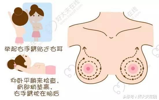 乳房自检只需三步，提前发现可以预防乳腺癌！