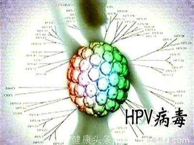 哪些人需要做HPV筛查？如果发现已经感染HPV怎么办？