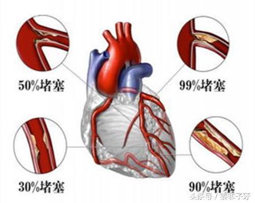 北京宝仁中医医院：这套理论，是无数心脏疾病患者的福音