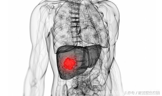 这4种检查方法能判断是否肝硬化，肝炎患者一定要学会！