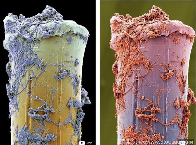 牙刷到底该多久换一次？3个月不换，显微镜下细菌毛骨悚然，比马桶脏100倍！