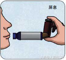 哮喘治疗中3种常见吸入装置的使用方法和注意事项！