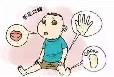 家长们要学会为孩子预防手足口病的发生！