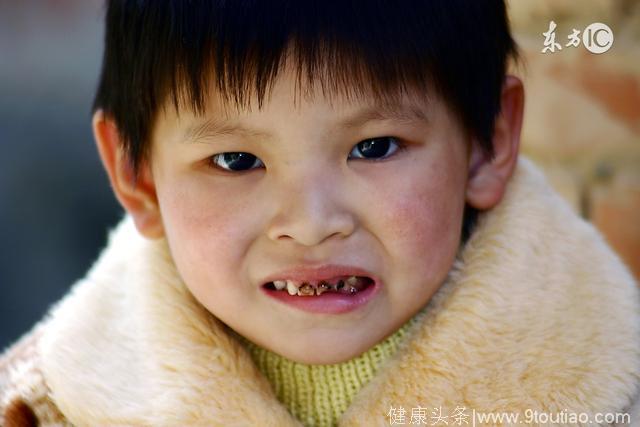 妈妈太无知，导致5岁宝宝的牙齿全部烂完，连医生都觉得太可憎了