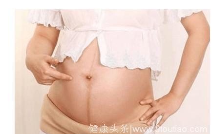 孕妇以为这只是胎动，到医院检查后，医生却要孕妇做引产
