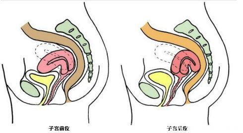 子宫内膜薄影响怀孕吗？子宫后位呢？