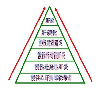 肝病发展的六层“金字塔”