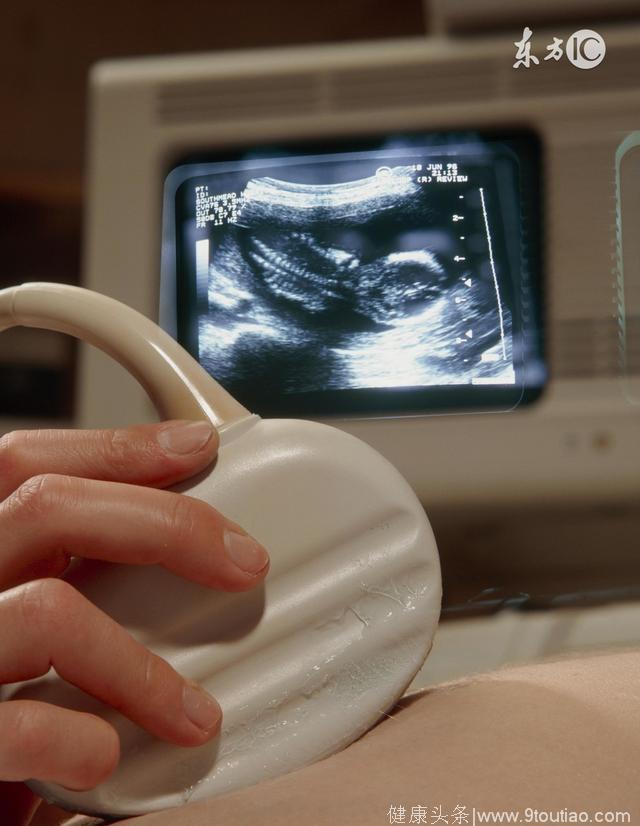 从怀胎十月到一朝分娩，准妈妈们有没有犯这些孕病？