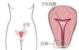 子宫内膜息肉手术后讲究哪些护理技巧