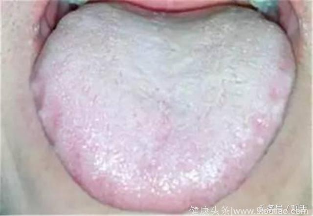 舌诊科普篇：身体出现问题，舌头会有哪些信号？转发能救人！