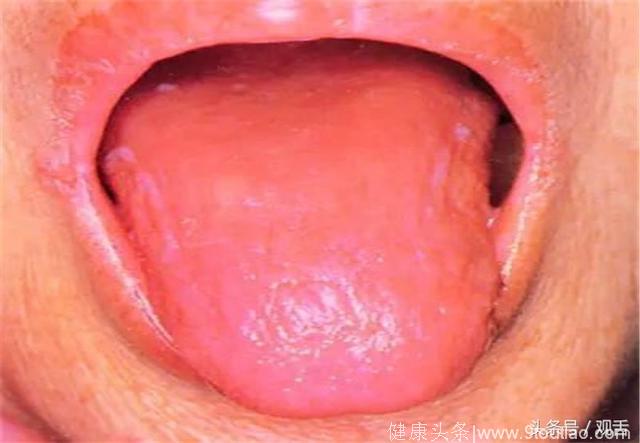 舌诊科普篇：身体出现问题，舌头会有哪些信号？转发能救人！
