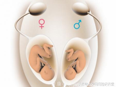 这4点身体的变化能看出孕妇肚子里是男是女，准确率高达99%