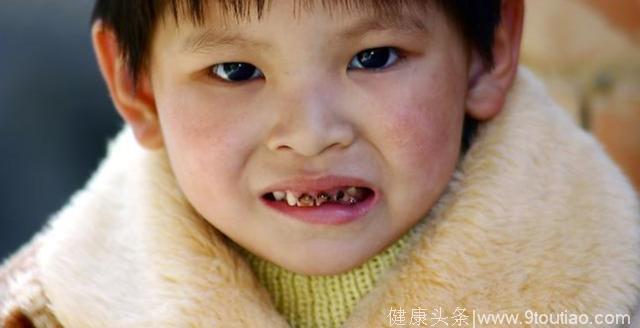 妈妈太无知，导致5岁宝宝牙齿全烂掉，医生看了很是生气！