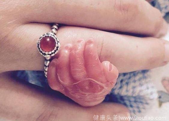 孕妇因车祸早产 出生6个月婴儿死前紧握妈妈的手 好感动