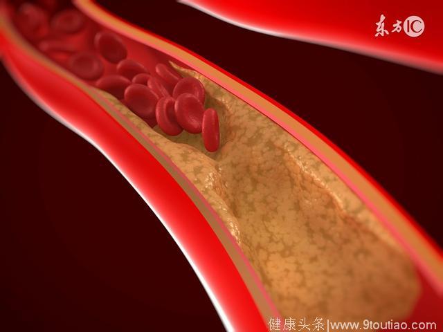 有能快速清除血管垃圾的食物吗？血稠吃什么？如何养护血管？