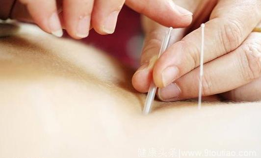 彭静山：针灸刺法的训练