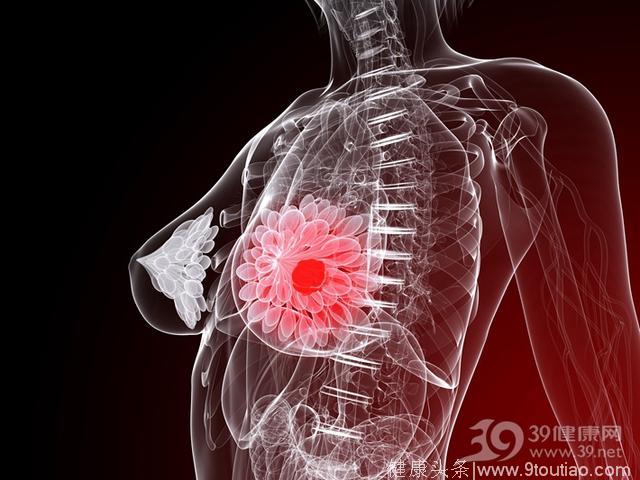 医生：一种乳腺增生可能癌变，远离诱因是关键！