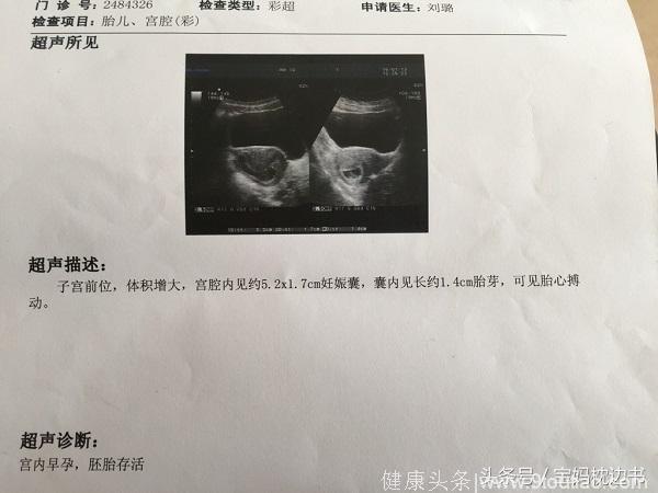 很多孕妈在去医院做B超后，结果都显示没胎心，这是为什么呢？