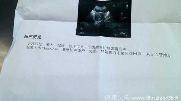 很多孕妈在去医院做B超后，结果都显示没胎心，这是为什么呢？