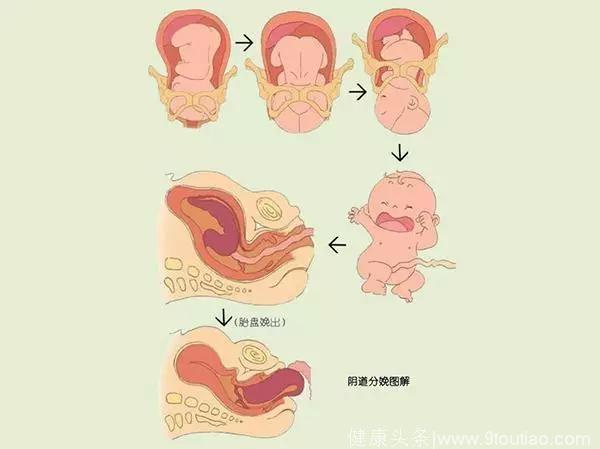 孕妇分娩时，原来胎儿是这样从产道出生的！
