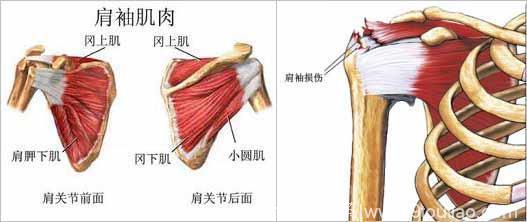 肩周炎和肩袖损伤怎么区分？肩部疼痛无力或是肩袖损伤！