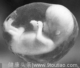 孕检查出“海豹胎” 孕妈强行生下 医生怒斥孕妇无知！
