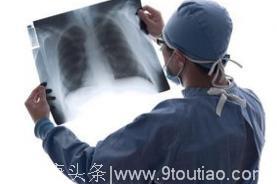 专家介绍诊断肺癌的三大手段
