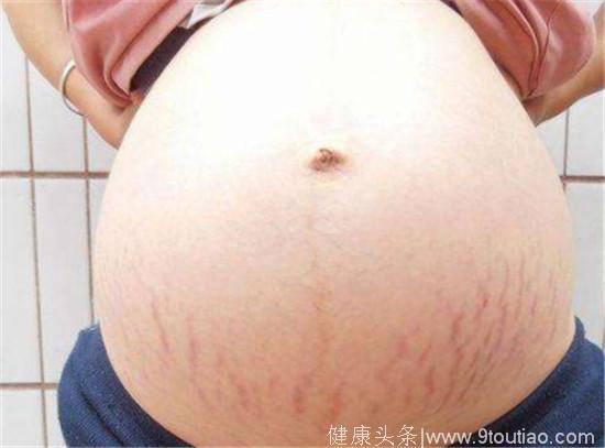 37岁孕妈肚子超大，结果剖腹生出来是这样的“双胞胎”