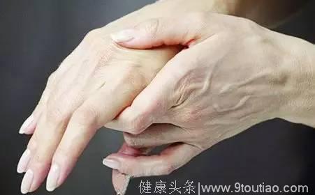 手指发麻竟然这么可怕？能预示十种疾病！