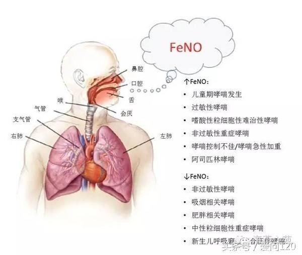 2017GINA一氧化氮（FENO）检查在哮喘治疗临床应用中的最新解读！