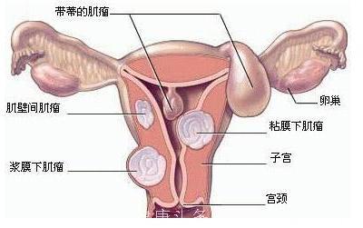 孕期腹痛不能掉以轻心，胎儿很危险！