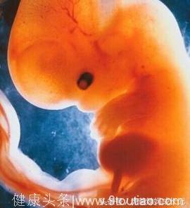 孕妇产检查出“海豹胎”，妈妈坚持生下，产科医生怒斥产妇无知！