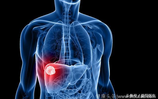 身上哪一种炎症是肝癌元凶？