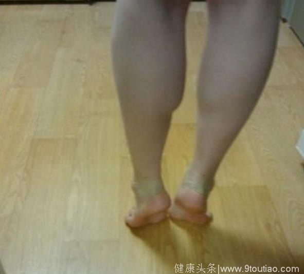 “小粗腿”穿裙子太难看！瑜伽老师教你几招，让你腿围慢慢缩小