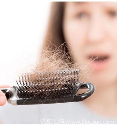 为什么头发老是掉的厉害是什么原因 如何护理头发