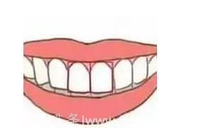 精准测试：牙齿能测试你的性格，不信来看看！