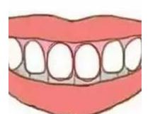 精准测试：牙齿能测试你的性格，不信来看看！