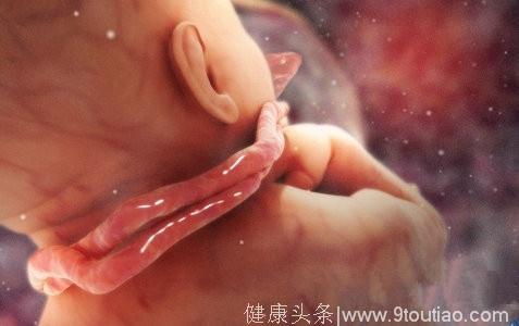 胎儿脐带绕脖需重视，孕妈需要这么做