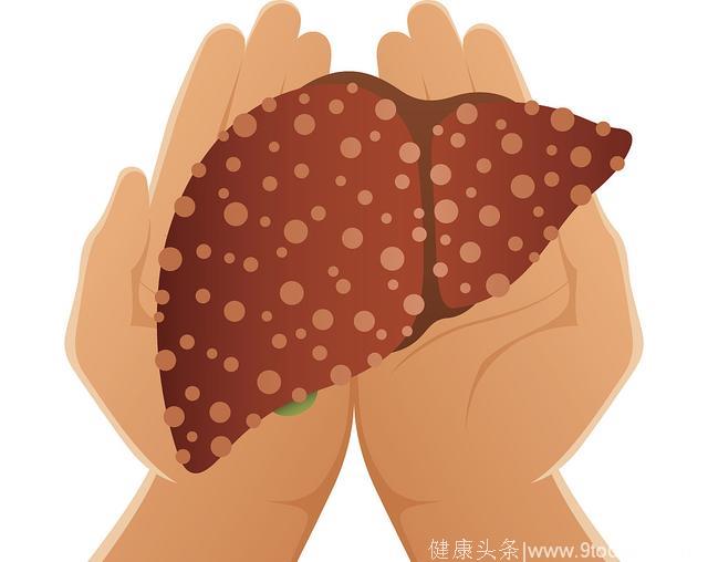 医生告诫：六个信号一出现，说明肝脏“藏毒”太深，不及时给肝脏“扫毒”，小心肝癌！