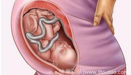 宝宝在妈妈肚子里也会扫除大便 那么大便都去哪了？答案肯定让你惊奇！
