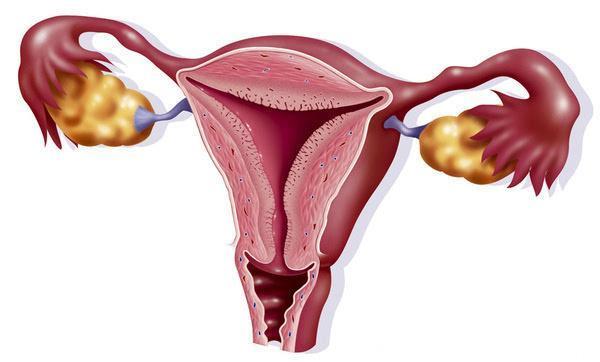 20%的30岁以上女性都患有子宫肌瘤，小心，这是女性的天敌！