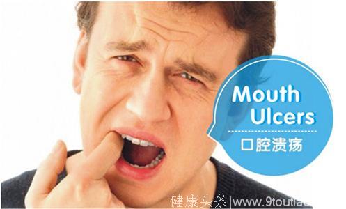 口腔溃疡多发季，我们应该怎样预防与治疗？