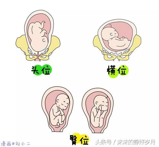 胎宝宝又调皮了，到了孕晚期还坚持臀位不转动，孕妈妈只能选择剖腹产了吗？
