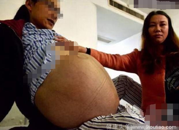 女子怀孕两年孩子都不出生，被老公赶出家门，检查后吓人一跳！