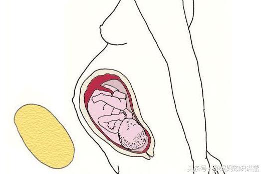 想知道胎儿发育每个月多大了吗？用这些水果可以描绘出，太像了